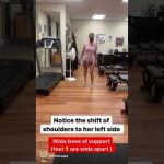 When to Begin Pilates After Hip Replacement: Expert Advice